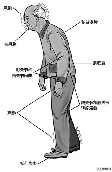 增强脊柱灵活性的简单锻炼方法介绍