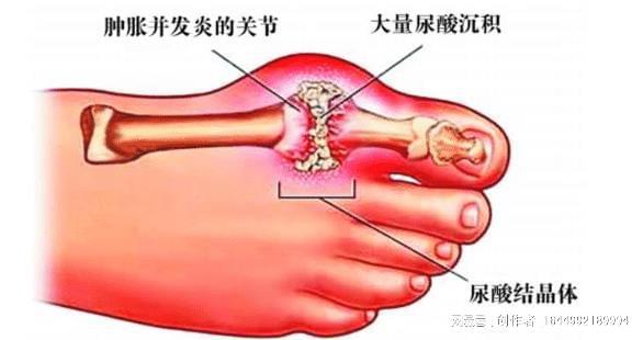 喝水促进肾脏功能与新陈代谢平衡，关键所在